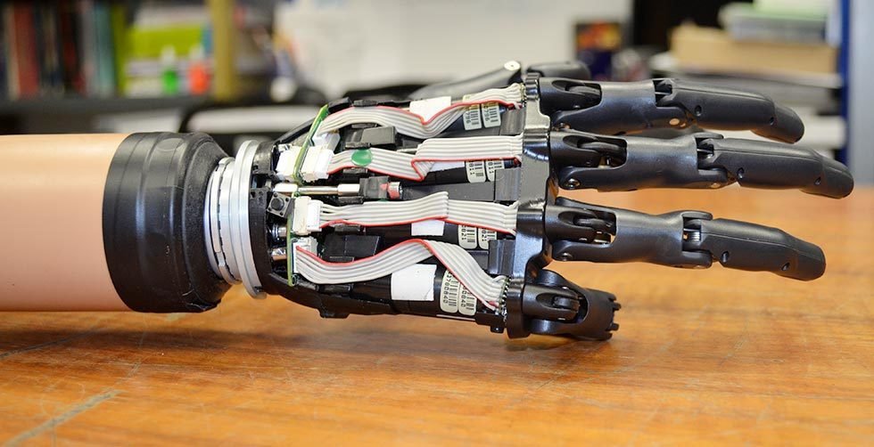 How prosthetics work? - Electrical e-Library.com