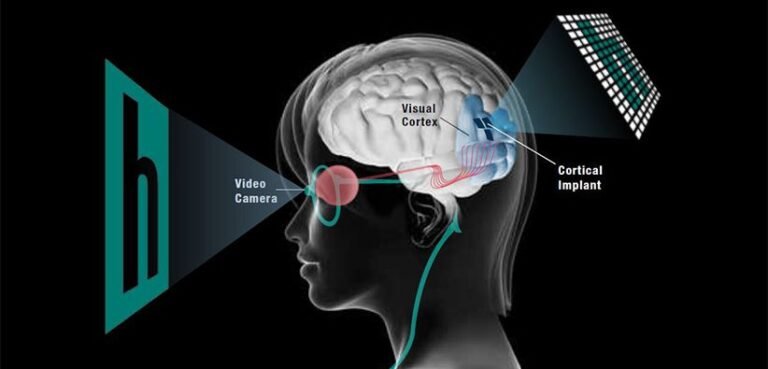 Artificial vision for blind people